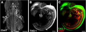 3 DISCO on Chick Embryo after double Immunostaining.